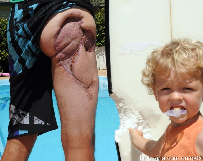 Ϥ�����ӳ���������˺ҧ���� ����������ͼ��