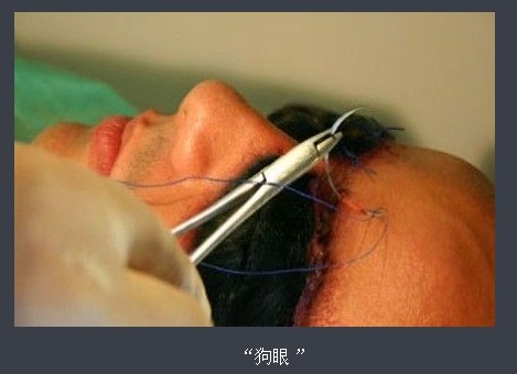 �ֲ���̬���������ݳɹ�ͷ ���˹�������ȫ����